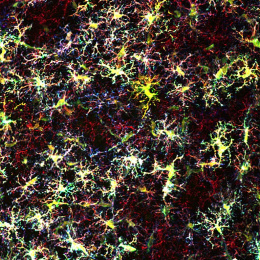 clusters of neurons in various colors, yellow dominant