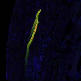 yellow worm-like columns against a wide river-like stretch of blue cells. Large red spots appear on the yellow structures.