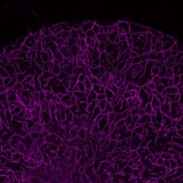 a half-circle of mesh-like magenta cells against a black background