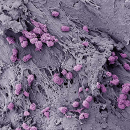 a gray clay-like field with clusters of round purple cells scattered throughout