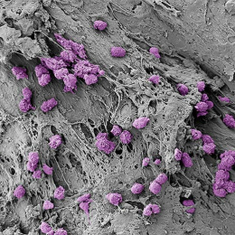 a gray clay-like field with clusters of round, ridged purple cells scattered throughout