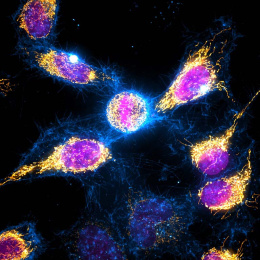 large glowing cells in a loose cluster. The nuclei are pink, surrounded by orange and white. In the background, blue cells linger.