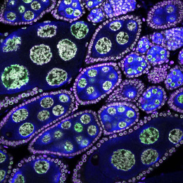 compartments of cells glowing purple, green, and blue—several large linked clusters i the middle with unbounded cells around them