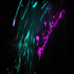 a close-up view of a curling magenta protein next to long thin bundles of axons (in cyan)