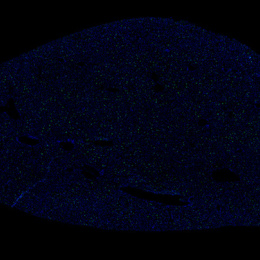 Liver structure with blue dots in a black background