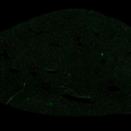 Liver structure with green dots in a black background