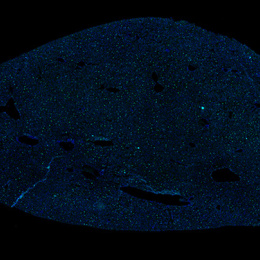 Liver structure with bright blue and green dots in a black background