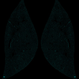 Liver structure with bright cyan dots in a black background