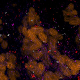 Three bright orange clusters with small scattered colorful cells in a black background