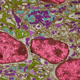 Complex purple, green, cyan and large pink cell structures