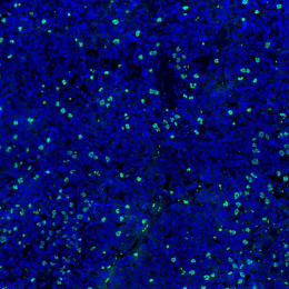 Dense blue structures with green fluorescent spots in a black background