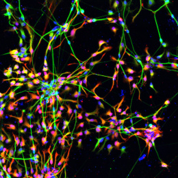 Colorful and bright complex neurons in a black background 2