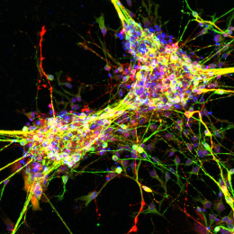 Colorful and bright complex neurons in a black background 3