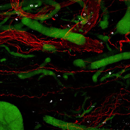 Columns of red and fluorescent green filaments in a black background