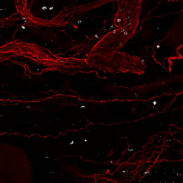 Red filament structures with white patches against a black background