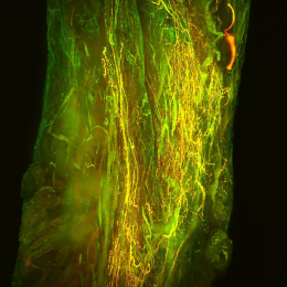 A column of fluorescent green filaments against a black background