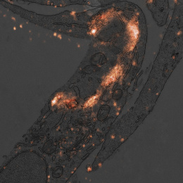  This electron microscopy image shows a section of a cell in which lysosomes were labeled with fluorescent antibodies using a specialized technique developed in our lab.
