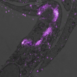 This electron microscopy image shows a section of a cell in which lysosomes were labeled with fluorescent antibodies using a specialized technique developed in our lab.
