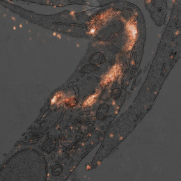  This electron microscopy image shows a section of a cell in which lysosomes were labeled with fluorescent antibodies using a specialized technique developed in our lab.