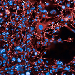 Fluorescence microscopy image showing a dense network of red, thread-like cell structures surrounding numerous bright blue cell nuclei.