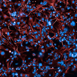 Fluorescence microscopy image showing a dense network of red, thread-like cell structures surrounding numerous bright blue cell nuclei.