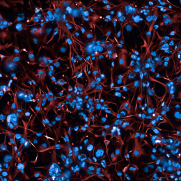 Fluorescence microscopy image showing a dense network of red, thread-like cell structures surrounding numerous bright blue cell nuclei.