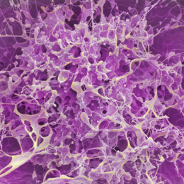 A close-up microscopic image showing a dense, web-like network of thin, branching filaments in pale yellow stretching across a vivid purple background, forming an intricate, sponge-like cellular structure with many interconnected pores.