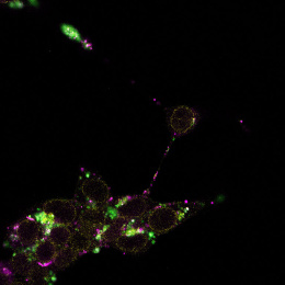 Green and purple lights illuminate a dark background, depicting mRNA nanoparticles escaping endosomes in a cellular environment.