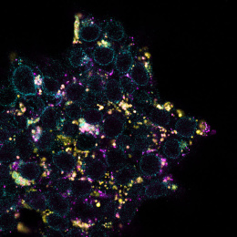 Detailed view of a cell with purple mRNA escaping yellow endosomes, highlighted by green and purple illumination.