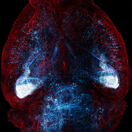 A brain illuminated with red and blue lights, showcasing a vibrant and dynamic visual representation of neural activity.
