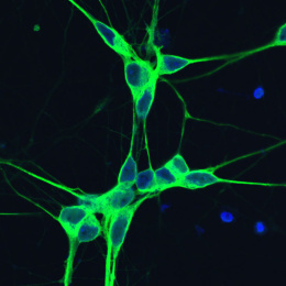 Neurons shown in green and blue light, with red vesicles from ginger, demonstrating successful binding and entry into nerve cells.