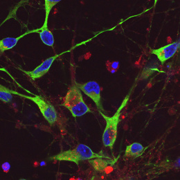 Neurons shown in green and blue light, with red vesicles from ginger, demonstrating successful binding and entry into nerve cells.