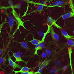 Neurons shown in green and blue light, with red vesicles from ginger, demonstrating successful binding and entry into nerve cells.