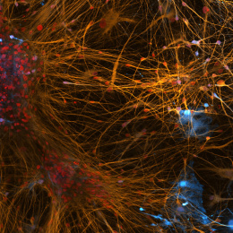 Close-up of a neuron, showcasing intricate details of a brain cell's structure and connections.