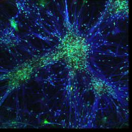 Close-up of a neuron, showcasing intricate details of a brain cell's structure and connections.